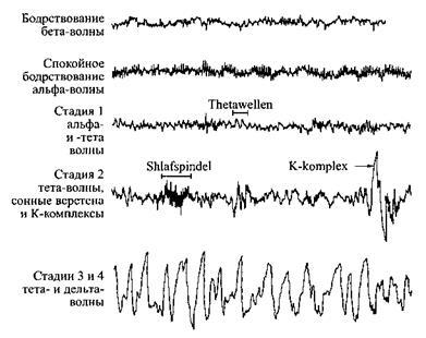 Ten seconds of five typical EEG various States of sleep and wakefulness.
Translated by «Yandex.Translator»